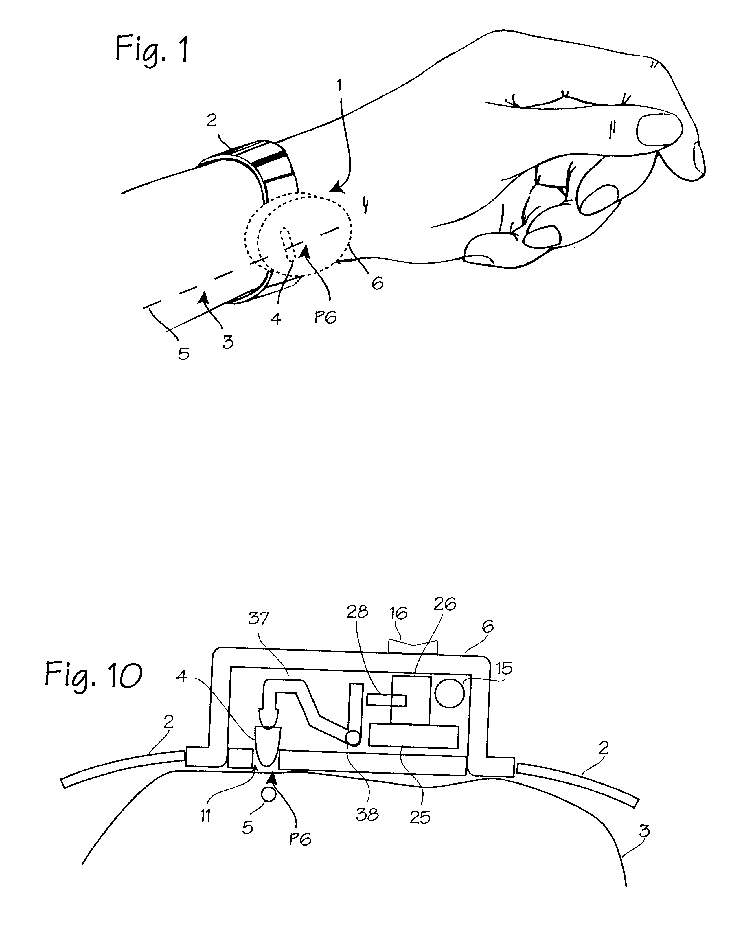 Automatically modulating acupressure device