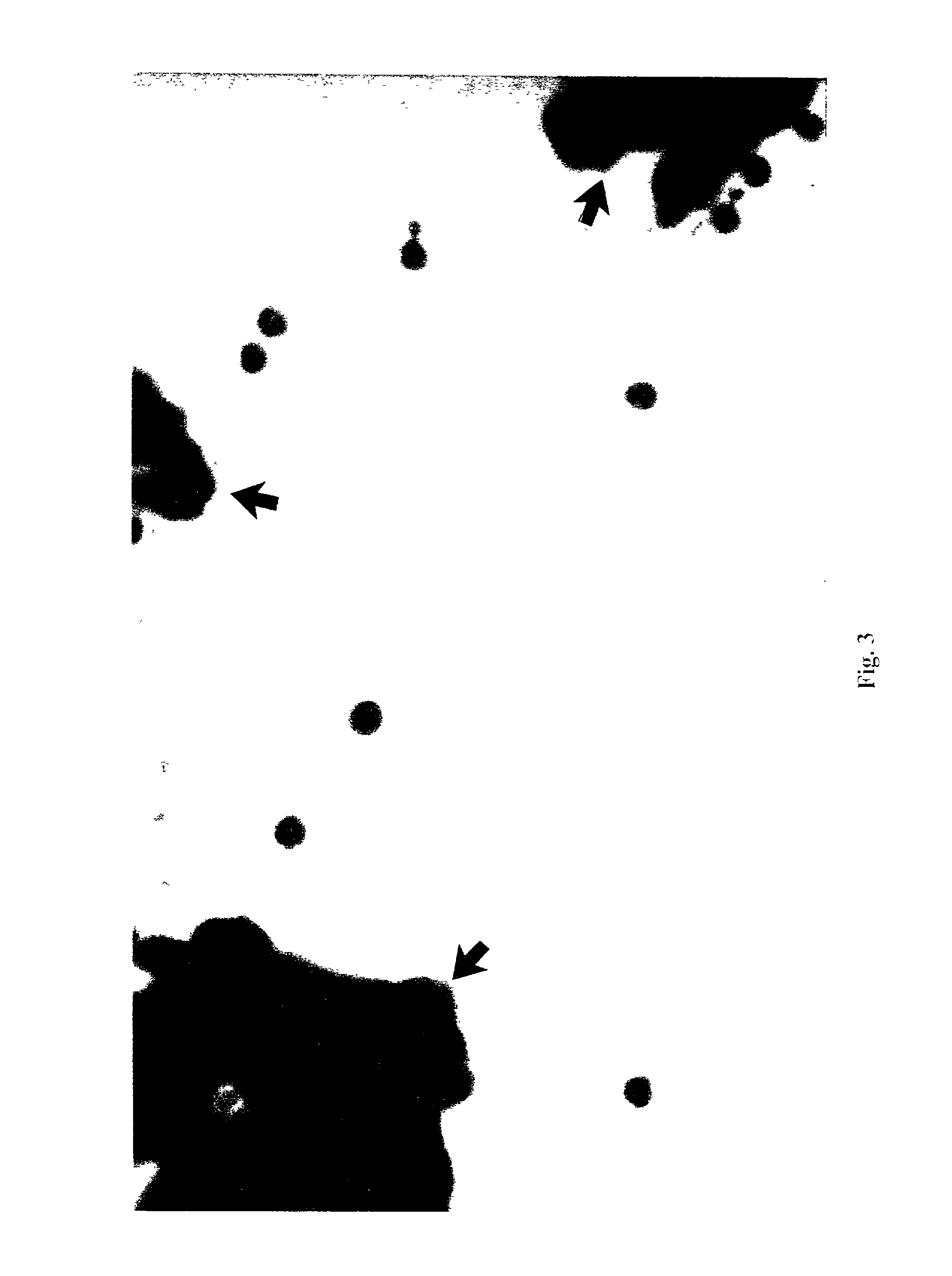 System and method for generating a profile of particulate components of a body fluid sample