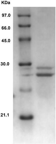 Method for preparing degreased soybean meal iron storage polypeptide by protease and application