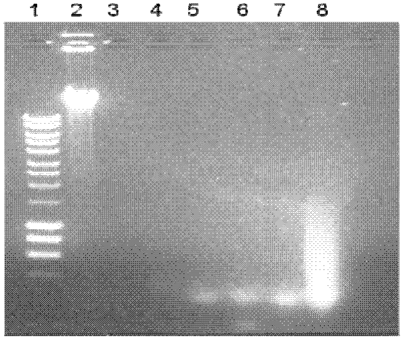 Preparation method of pathogenic bacterium DNAs (Deoxyribonucleic Acids) in clinical blood sample and kit