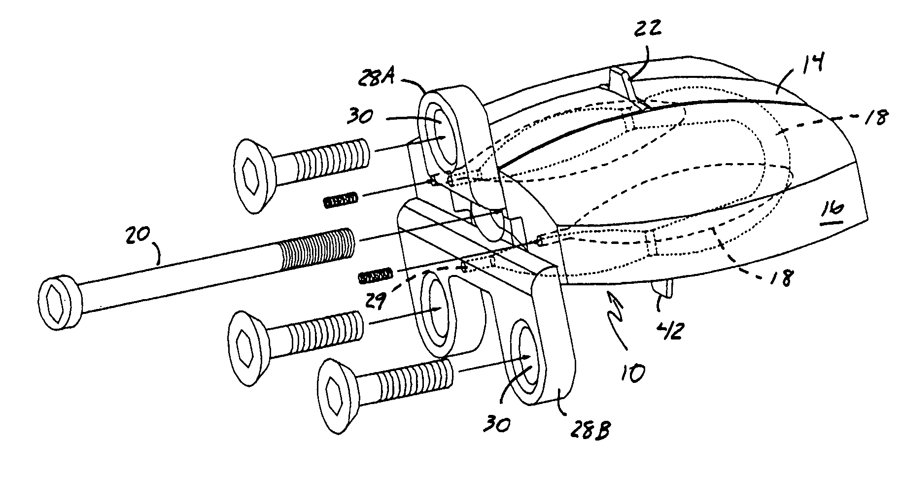 Total artificial intervertebral disc