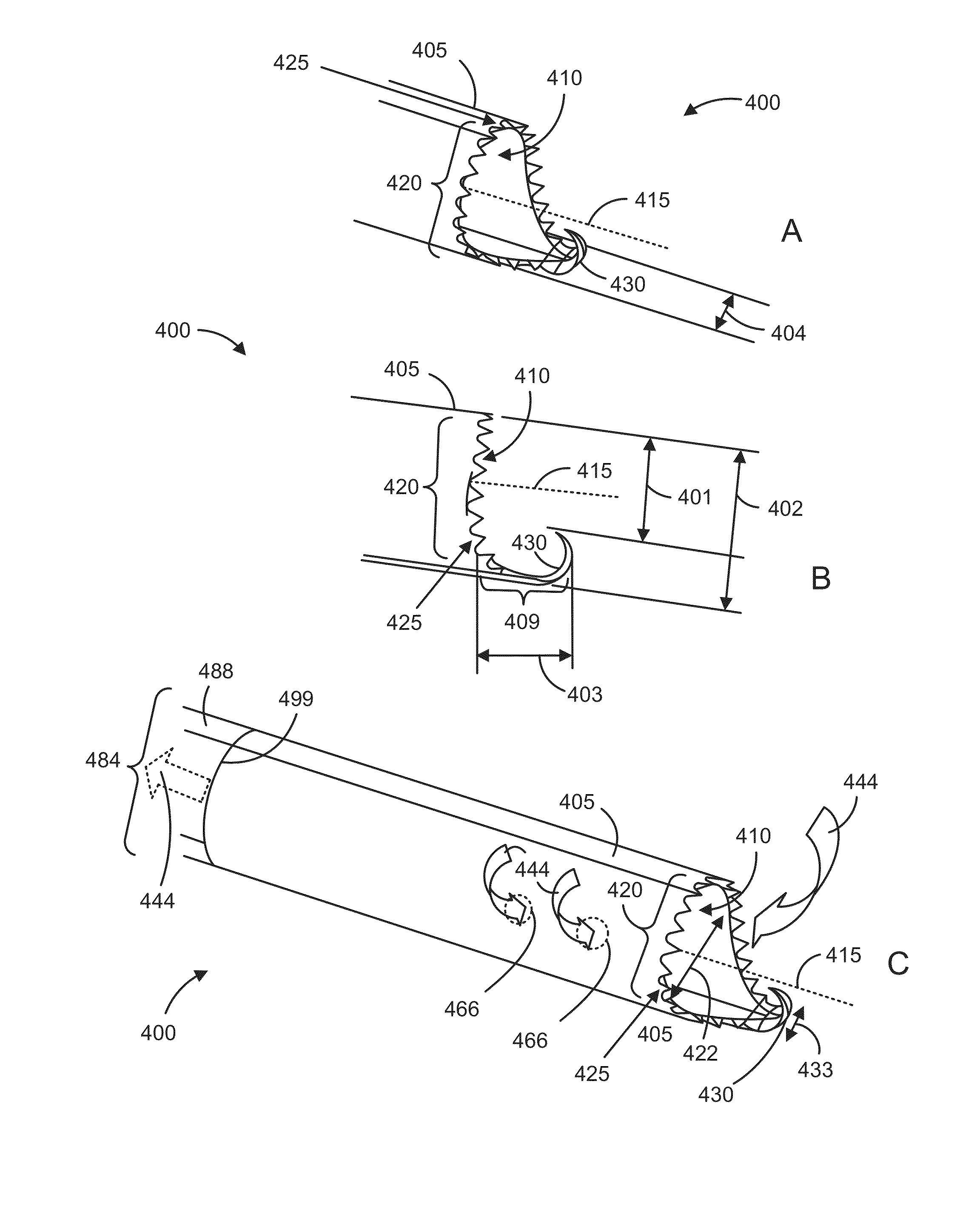 Anti-clogging device for a vacuum-assisted, tissue removal system