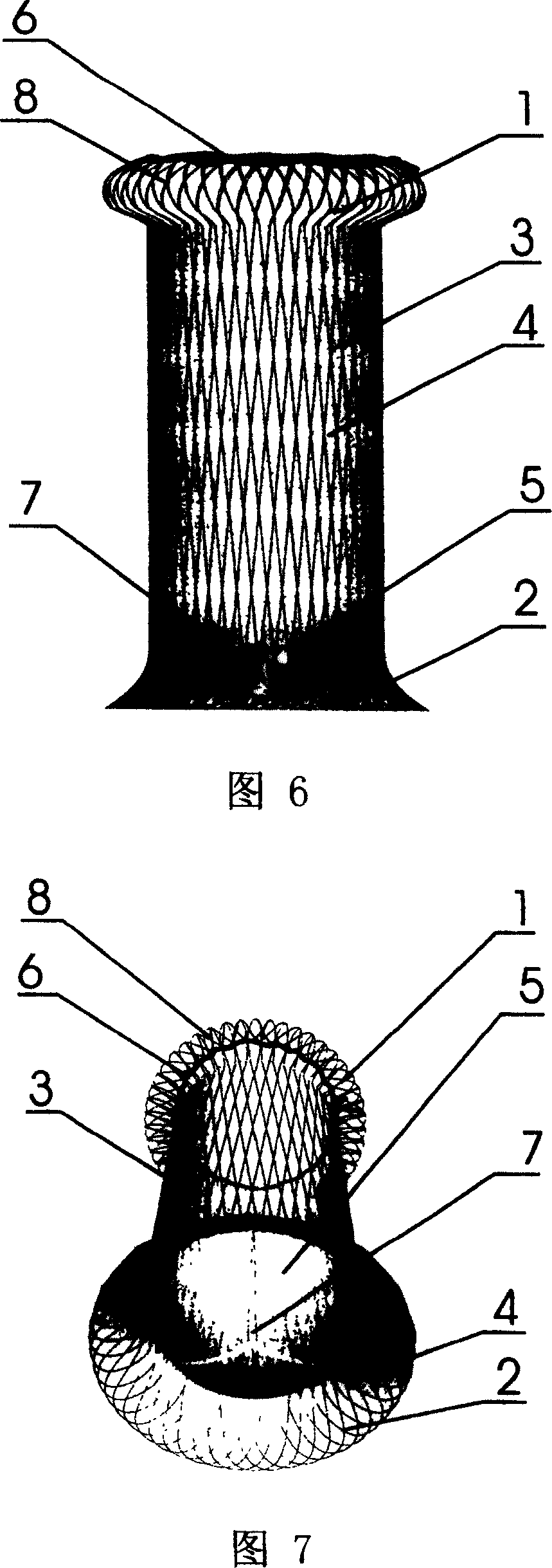 Cardia stent