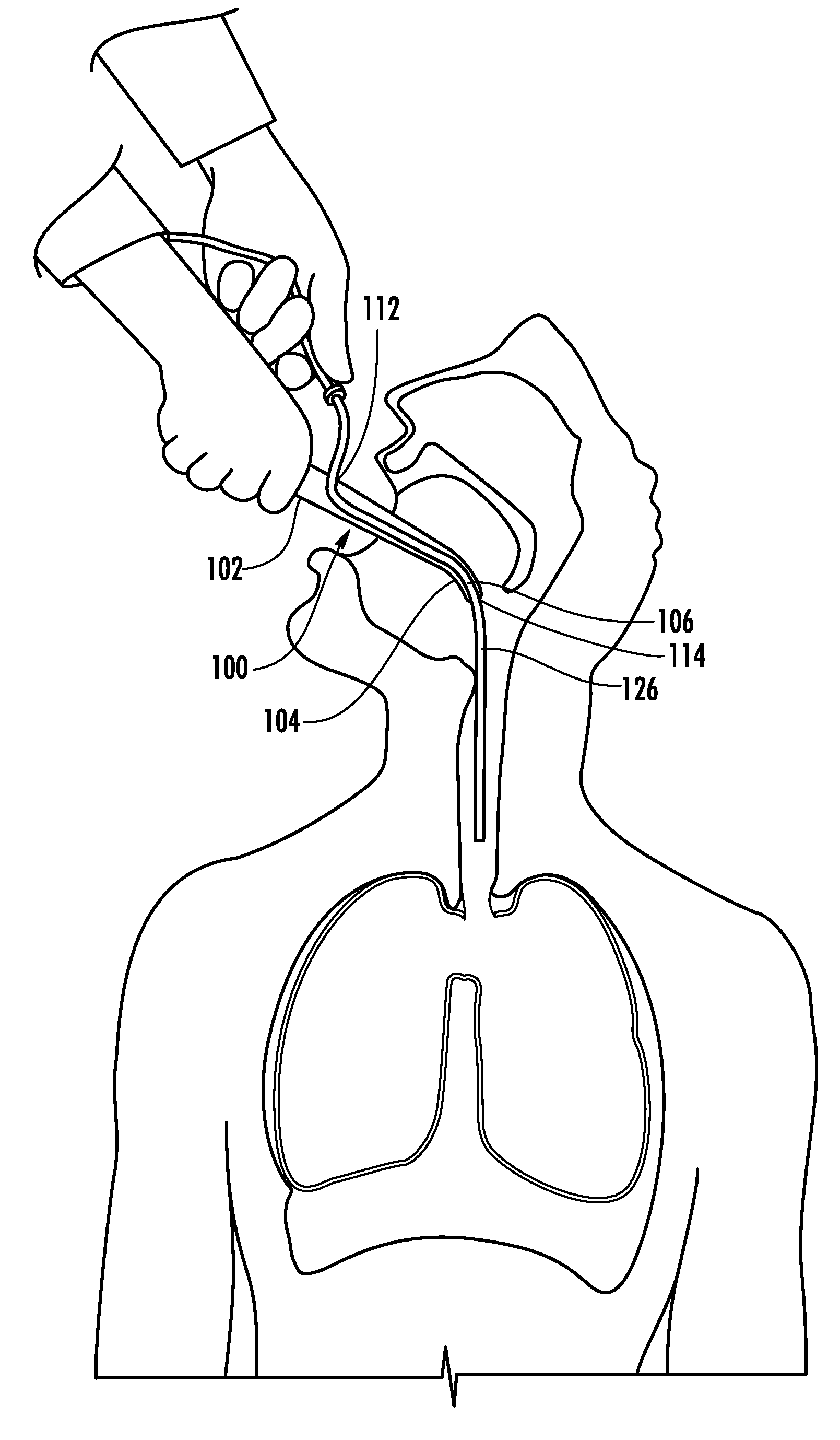 Insertion aid device