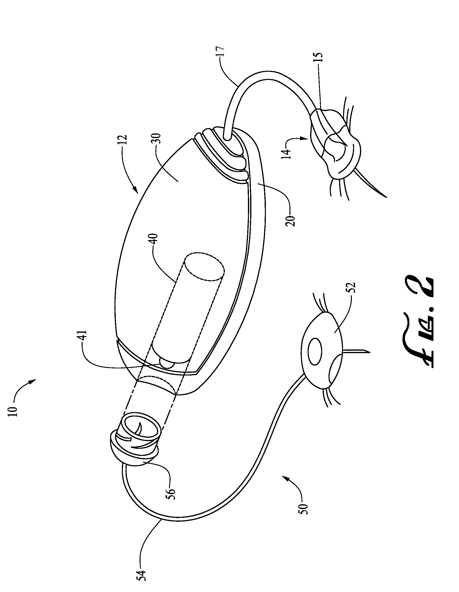 Engagement and sensing systems and methods