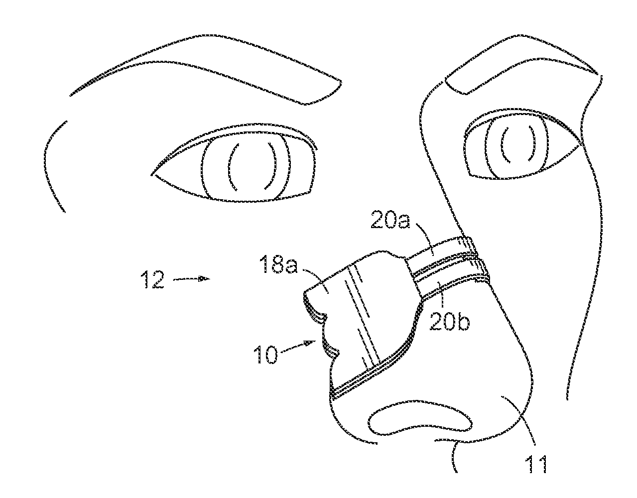 Economical Nasal Dilator and Method of Manufacture