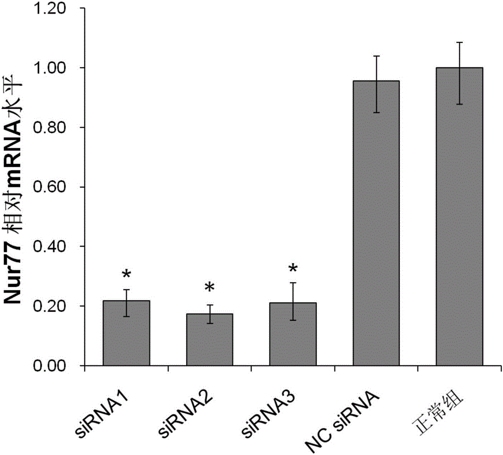 Small nucleic acid molecule capable of inhibiting vascular restenosis and applications of small nucleic acid molecule