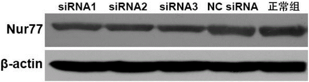 Small nucleic acid molecule capable of inhibiting vascular restenosis and applications of small nucleic acid molecule