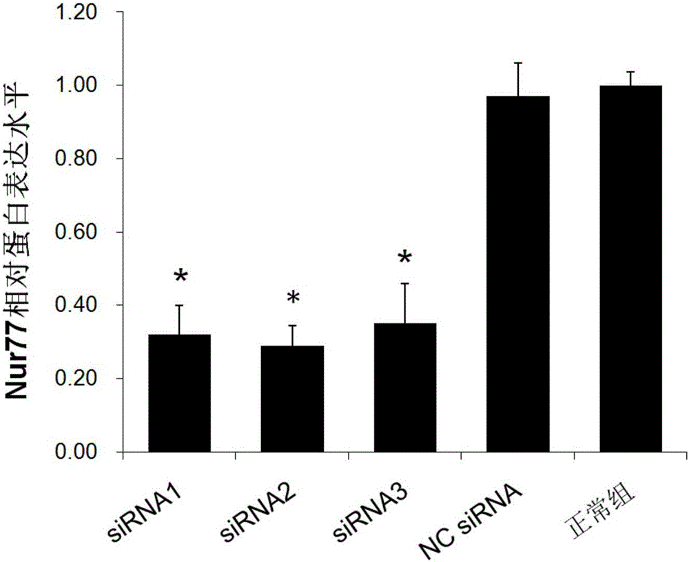 Small nucleic acid molecule capable of inhibiting vascular restenosis and applications of small nucleic acid molecule