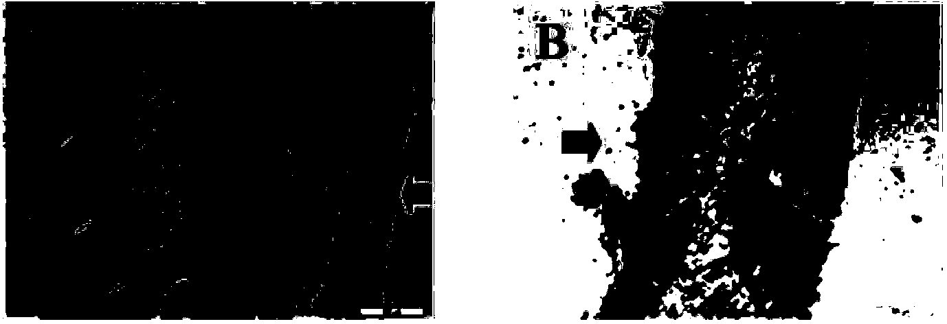 Silk-fibroi and hyaluronic-acid (HA) composite gel for injection and preparation and application thereof