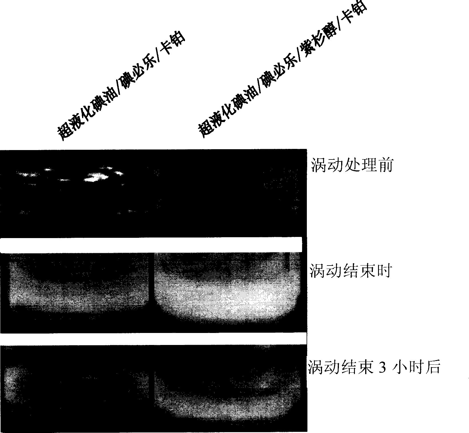 Paclitaxel mixed composition and water-in-oil type emulsion formulation for chemoembolization and preparation method thereof