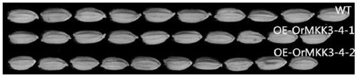 Rice grain type growth and development related coding gene and its application