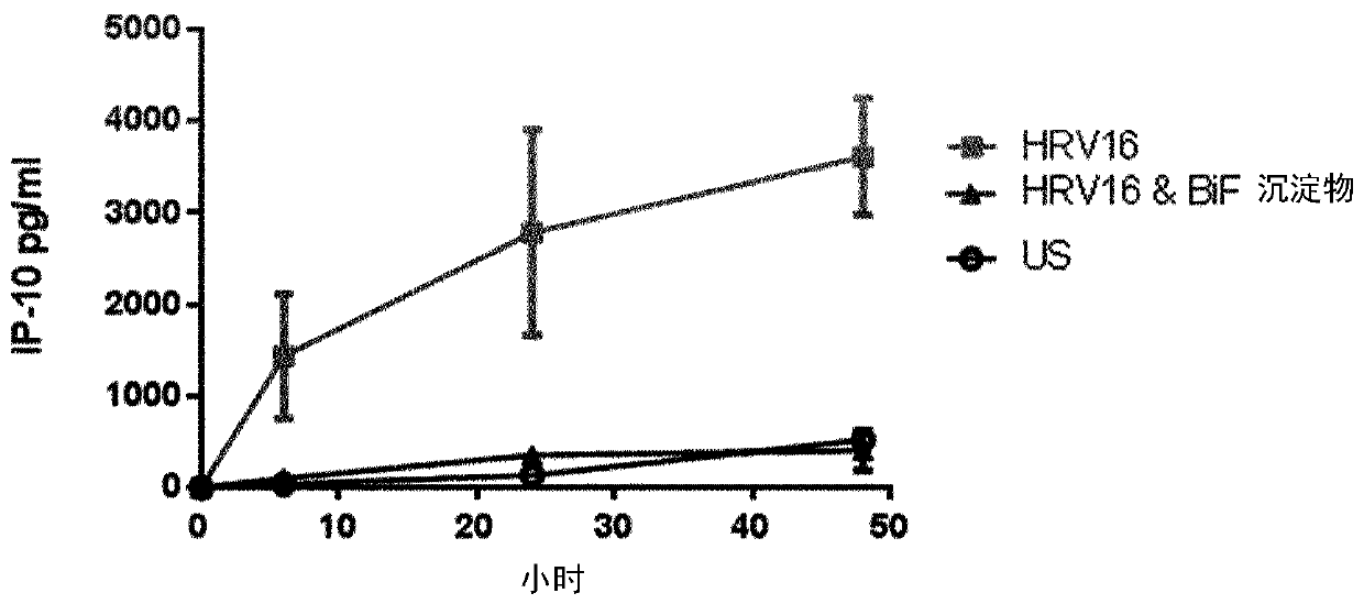 Bifidobacterium longum able to beneficially modulate immune response to respiratory virus infection