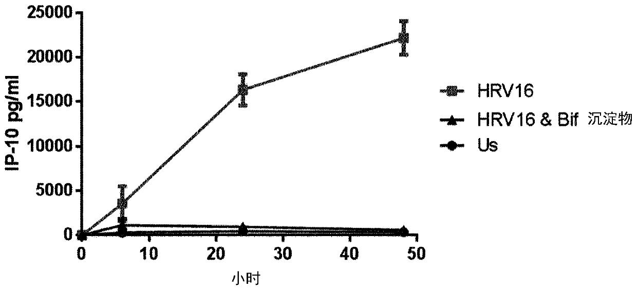 Bifidobacterium longum able to beneficially modulate immune response to respiratory virus infection