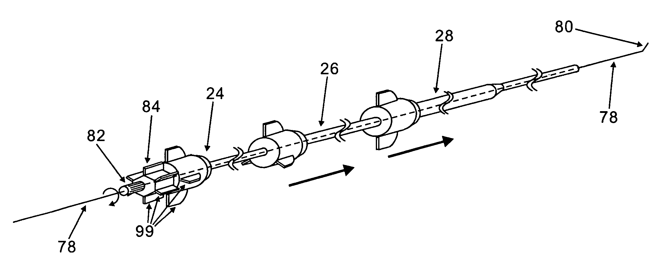 Easy drainage catheter assembly