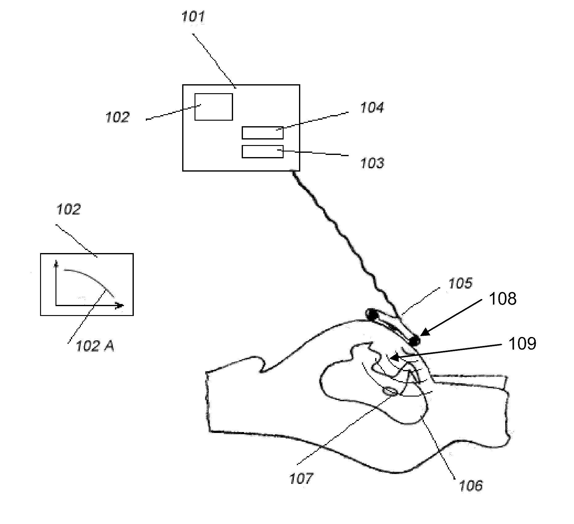 Method and a system for monitoring, contractions and/or a birth process and/or the progress and/or position of a fetus