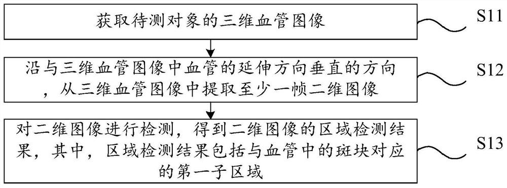 Blood vessel image detection method, detection model training method, related device and equipment