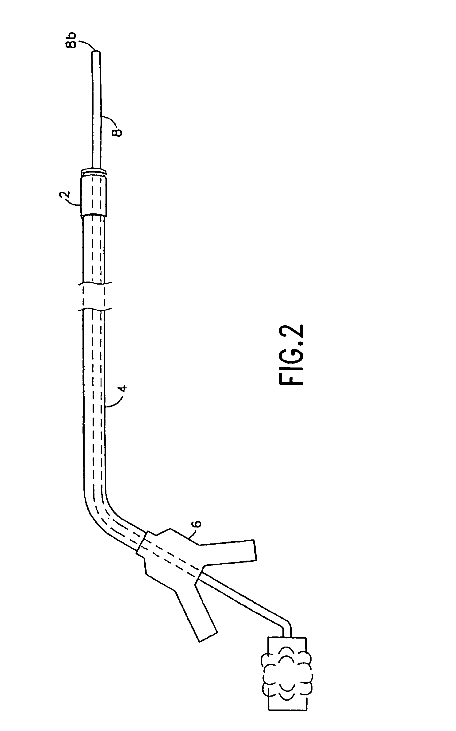 Integrated surgical staple retainer for a full thickness resectioning device