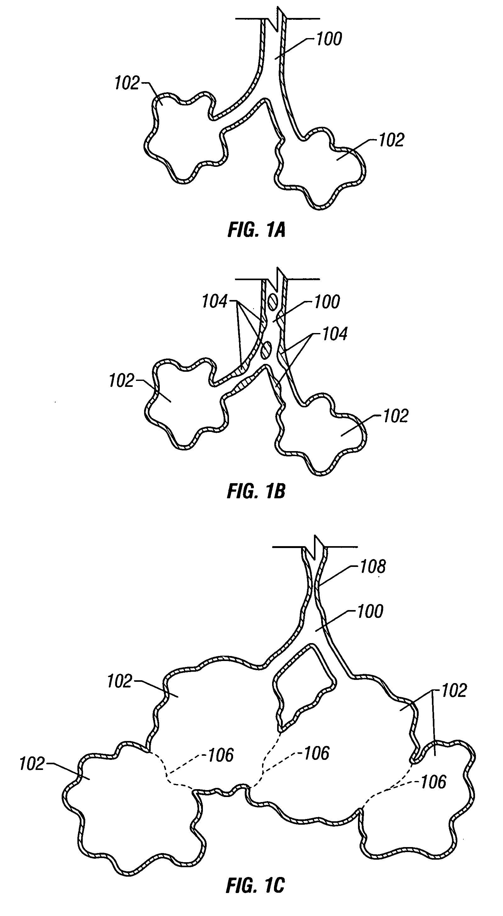 Multifunctional tip catheter for applying energy to tissue and detecting the presence of blood flow