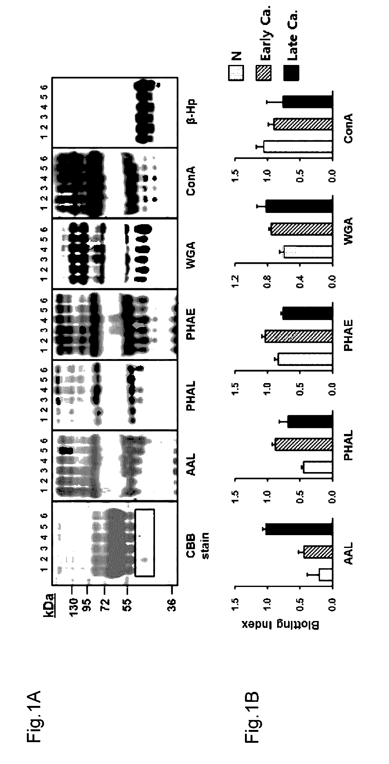 Novel diagnostic method for gastric cancer