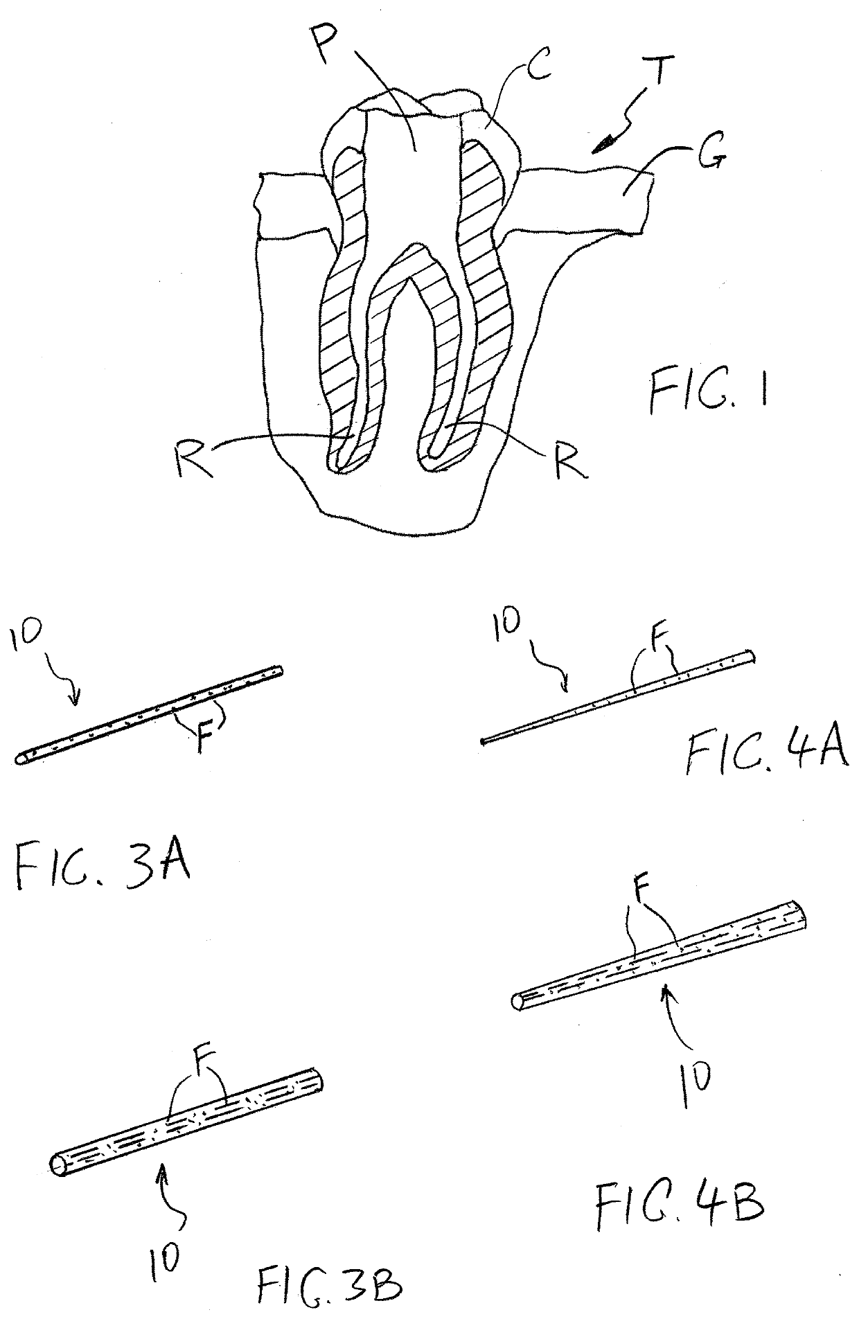 Absorbent inserts for tooth cavities