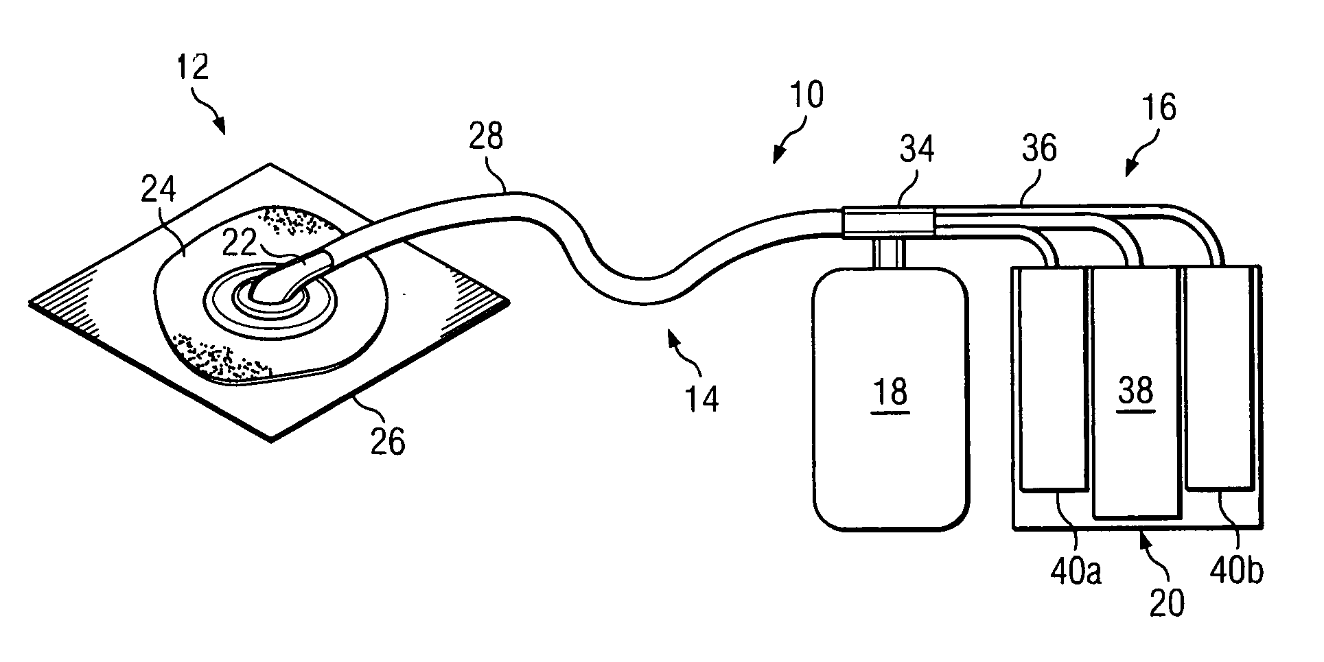 Systems and methods for improved connection to wound dressings in conjunction with reduced pressure wound treatment systems