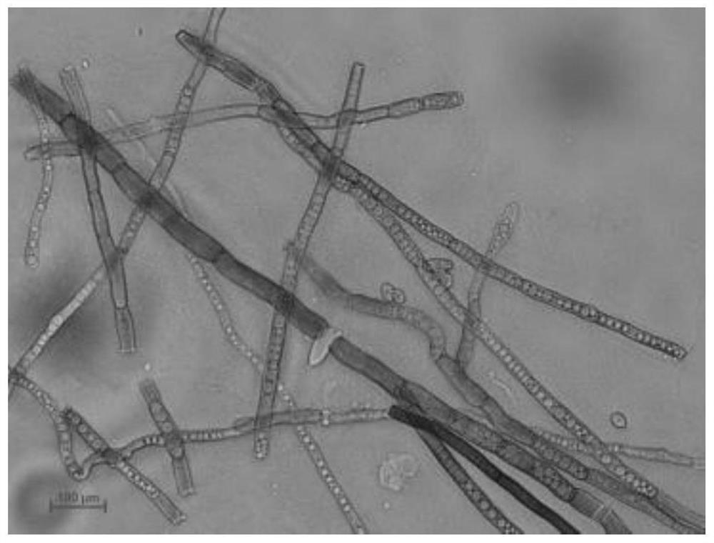 A strain of Cladosporium cladosporium with strong pathogenicity to citrus psyllids and its application