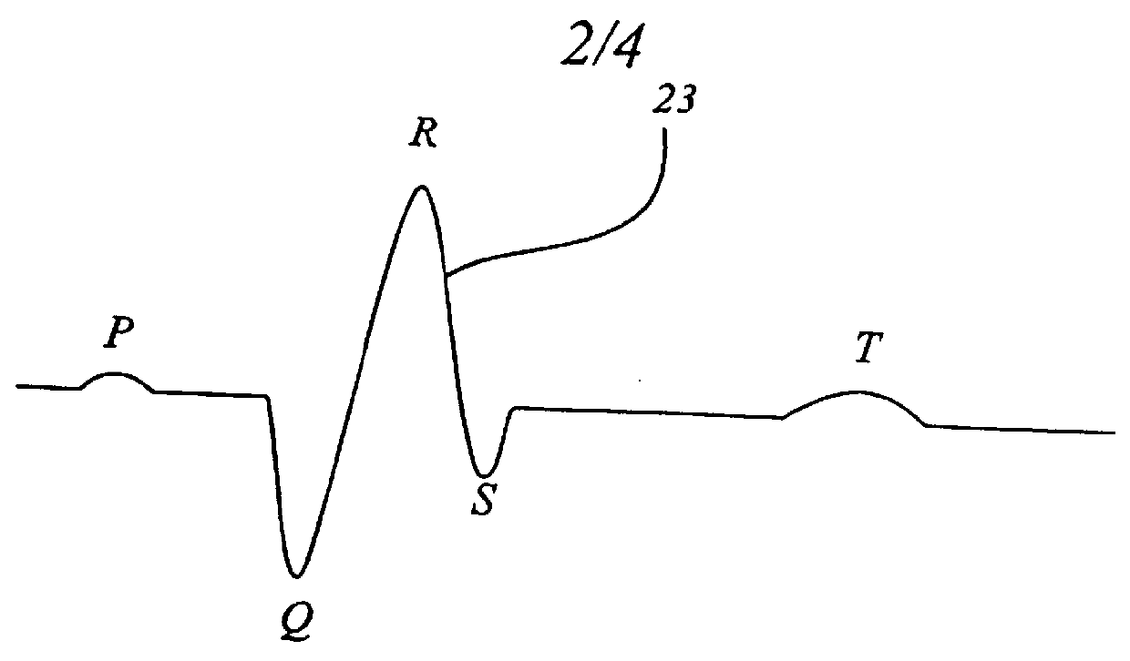 Device for determining the depth of anesthesia