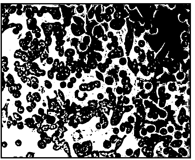 Human lung adenocarcinoma cell line and application thereof