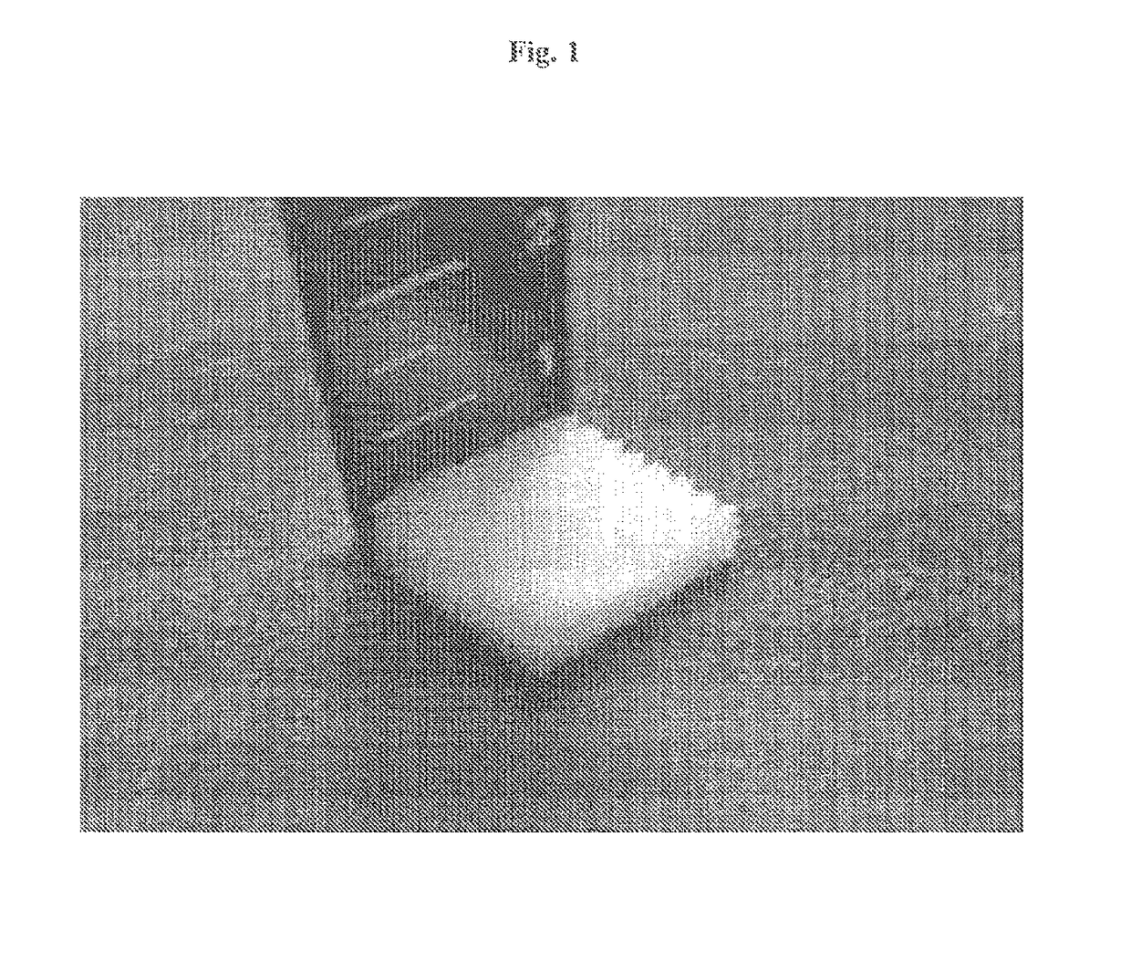 Complex support body for regenerating bone-cartilage, method for manufacturing thereof, and composition for treating bone and cartilage related diseases comprising same as active ingredient