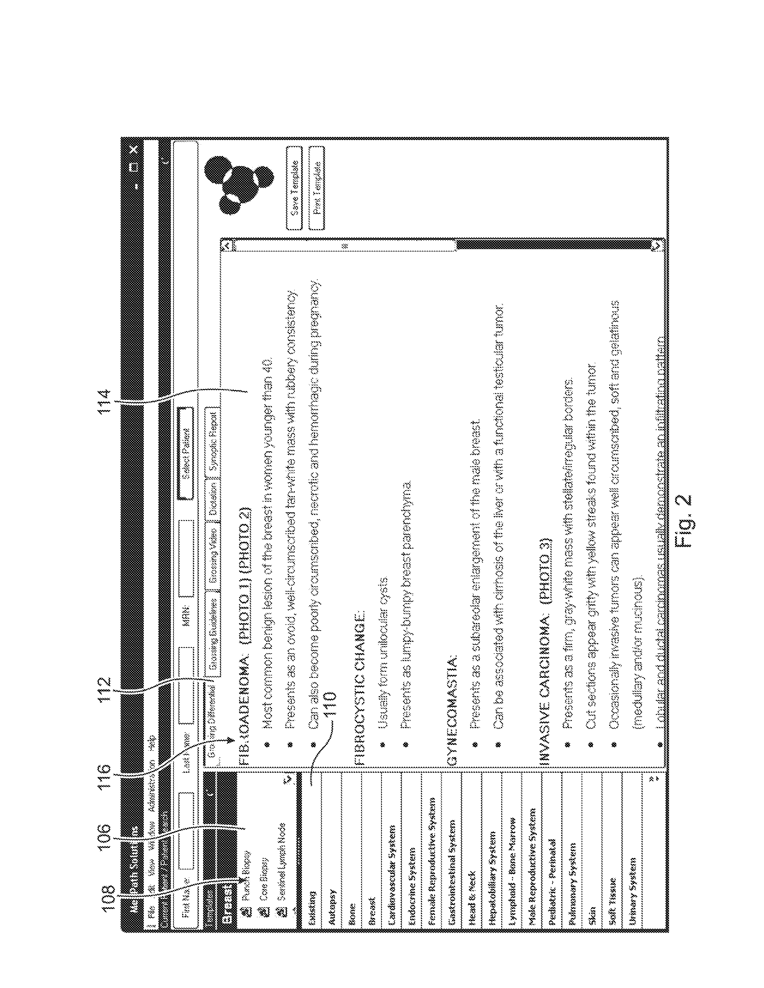 Computer based standardized method and apparatus for guiding decision support for surgical anatomic pathology operations