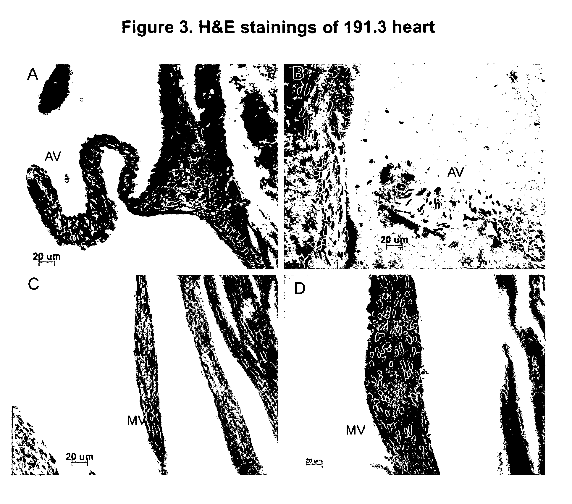 Mutant mice comprising a mutated type II procollagen alpha-1