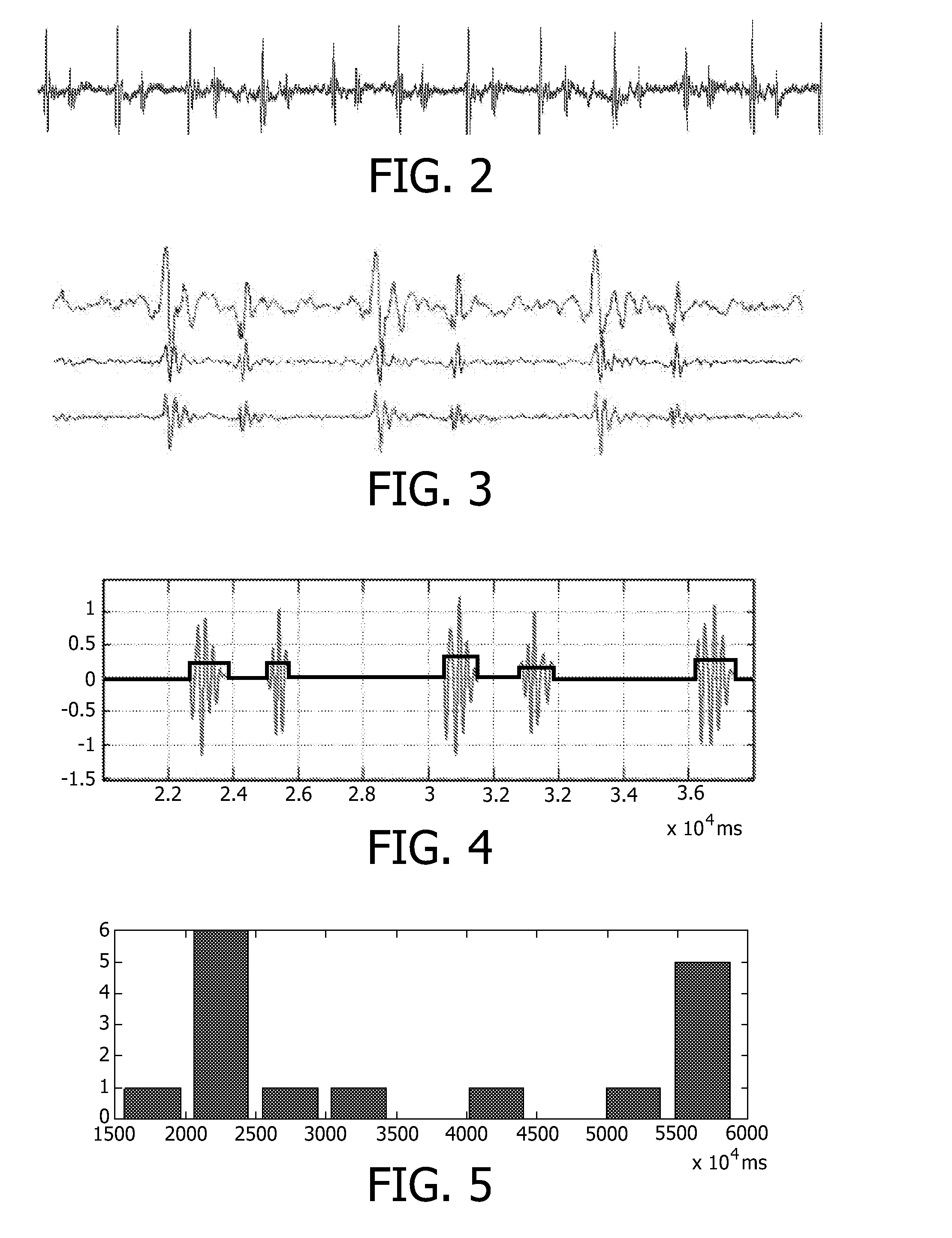 Method and system for processing heart sound signals