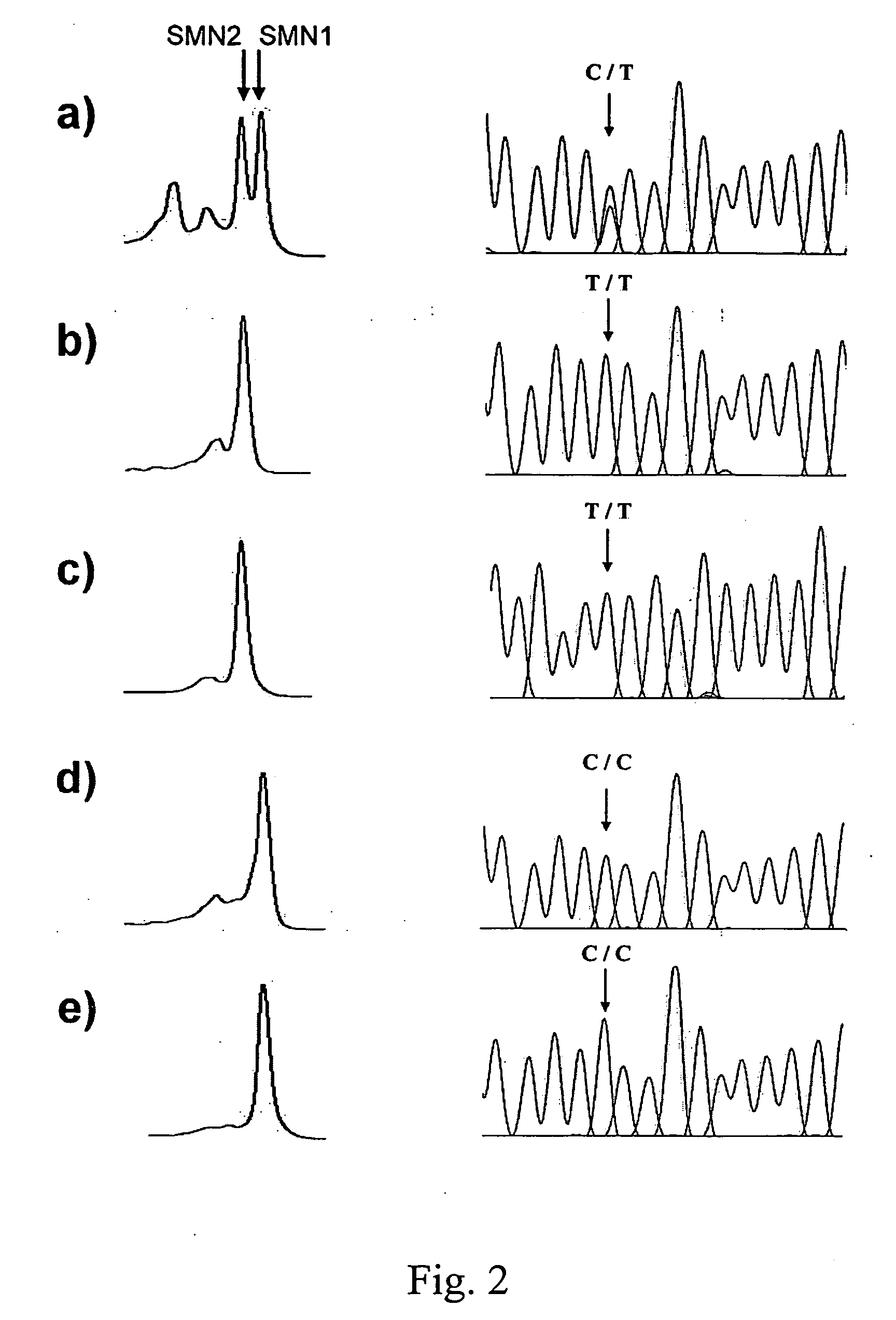 Methods for SMN genes and spinal muscular atrophy carriers screening