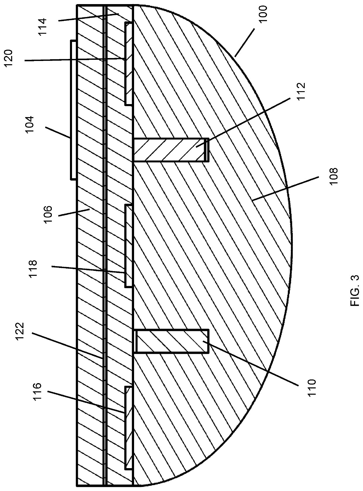 Detachable fretboard with customized frets