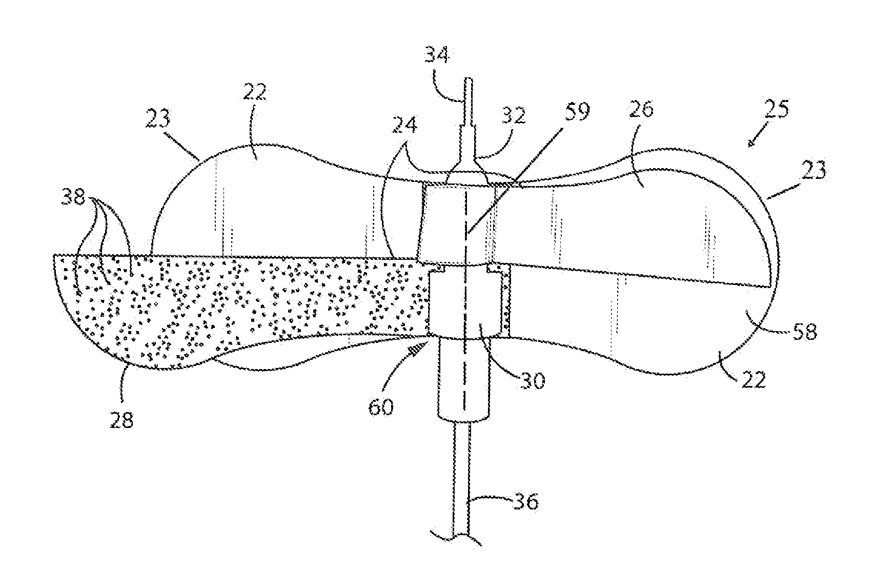 Peripheral Intravenous and Arterial Catheter Securement Device