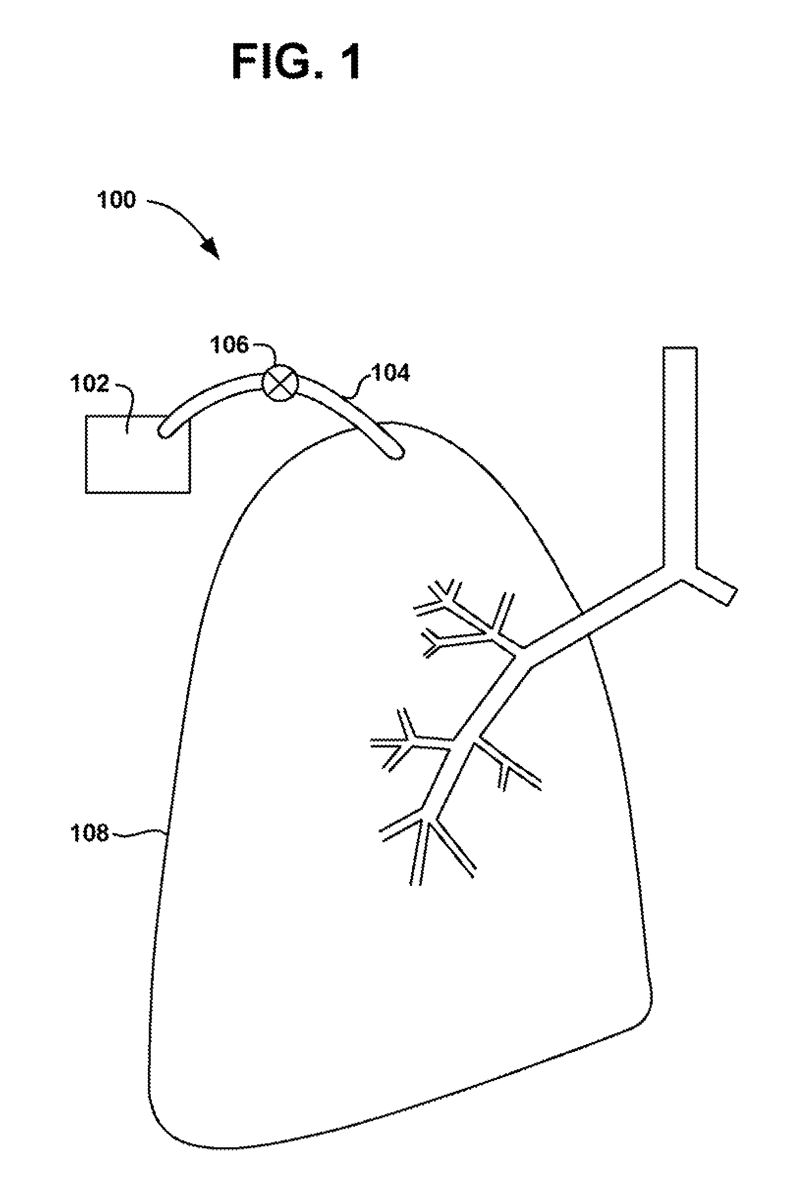 Visceral pleura ring connector