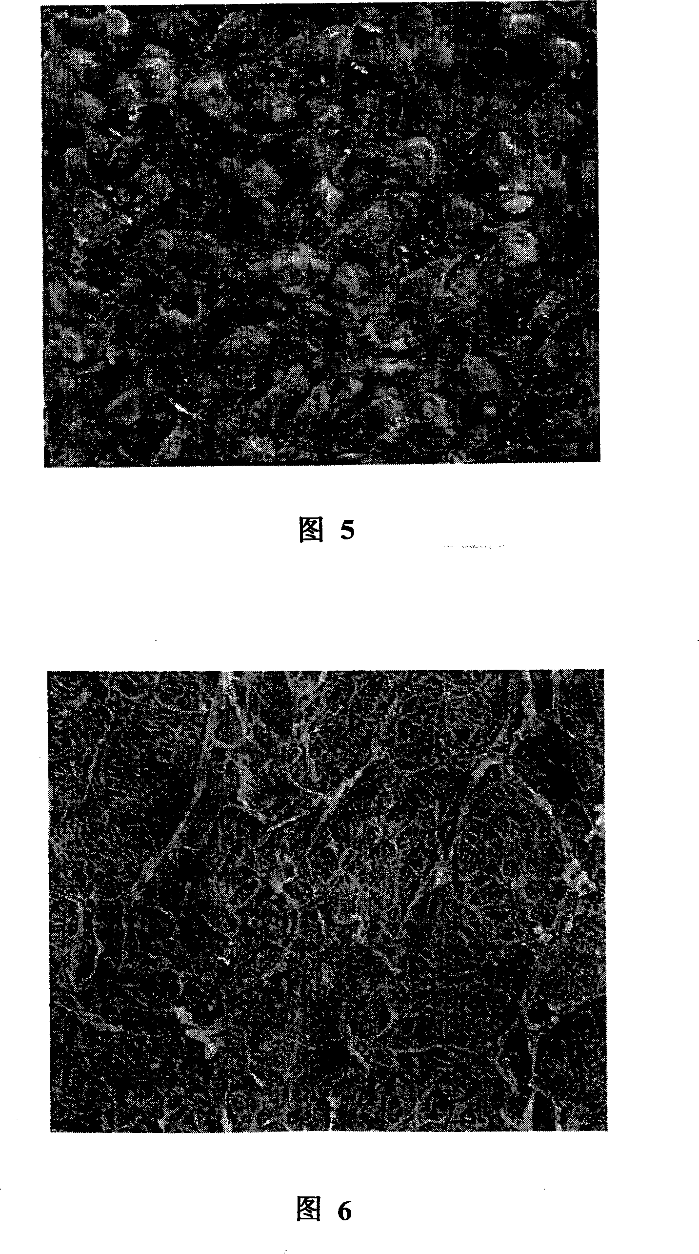 Ultra-high pressure preparation method of pig valved blood vessel acellular bracket