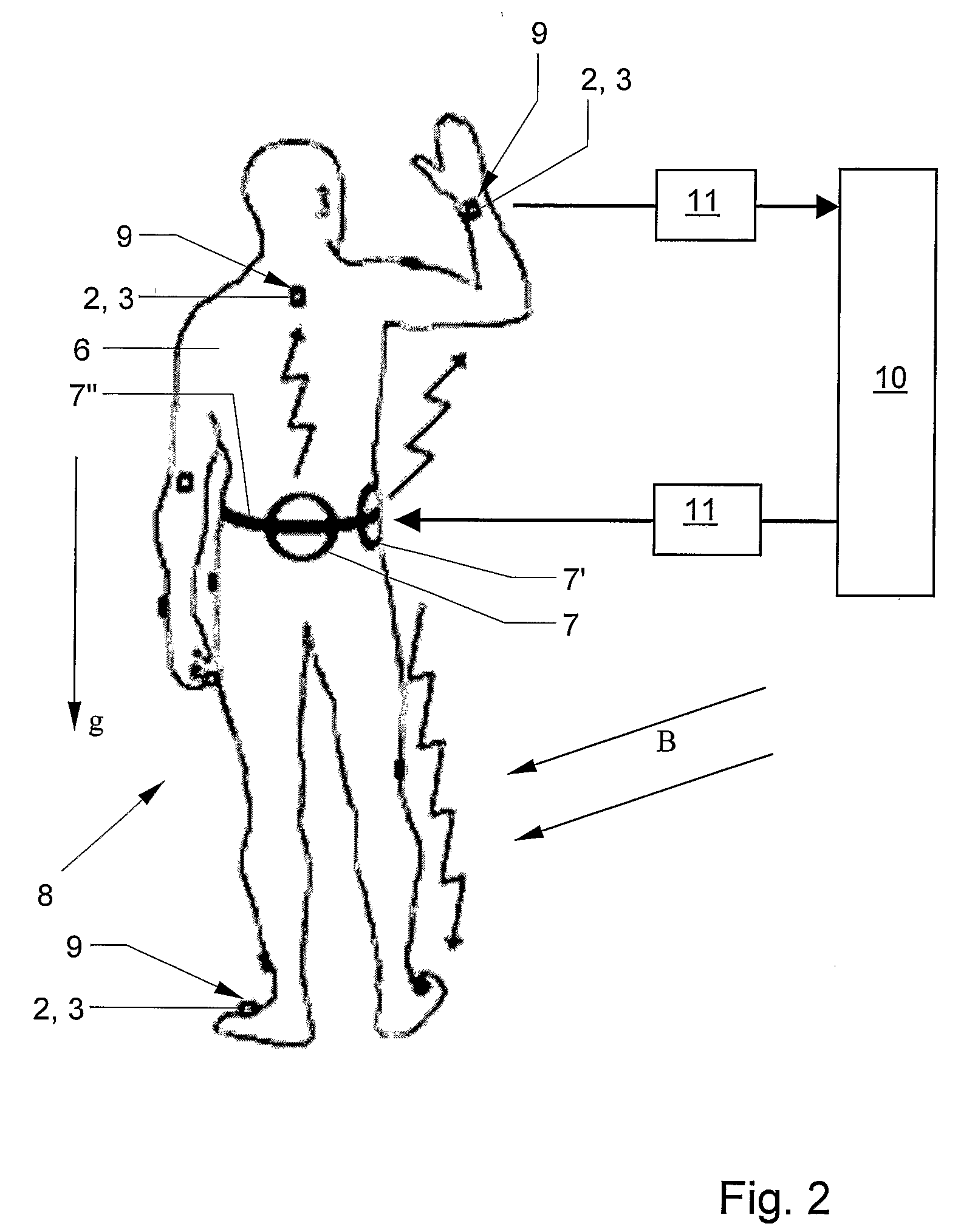 Motion tracking system