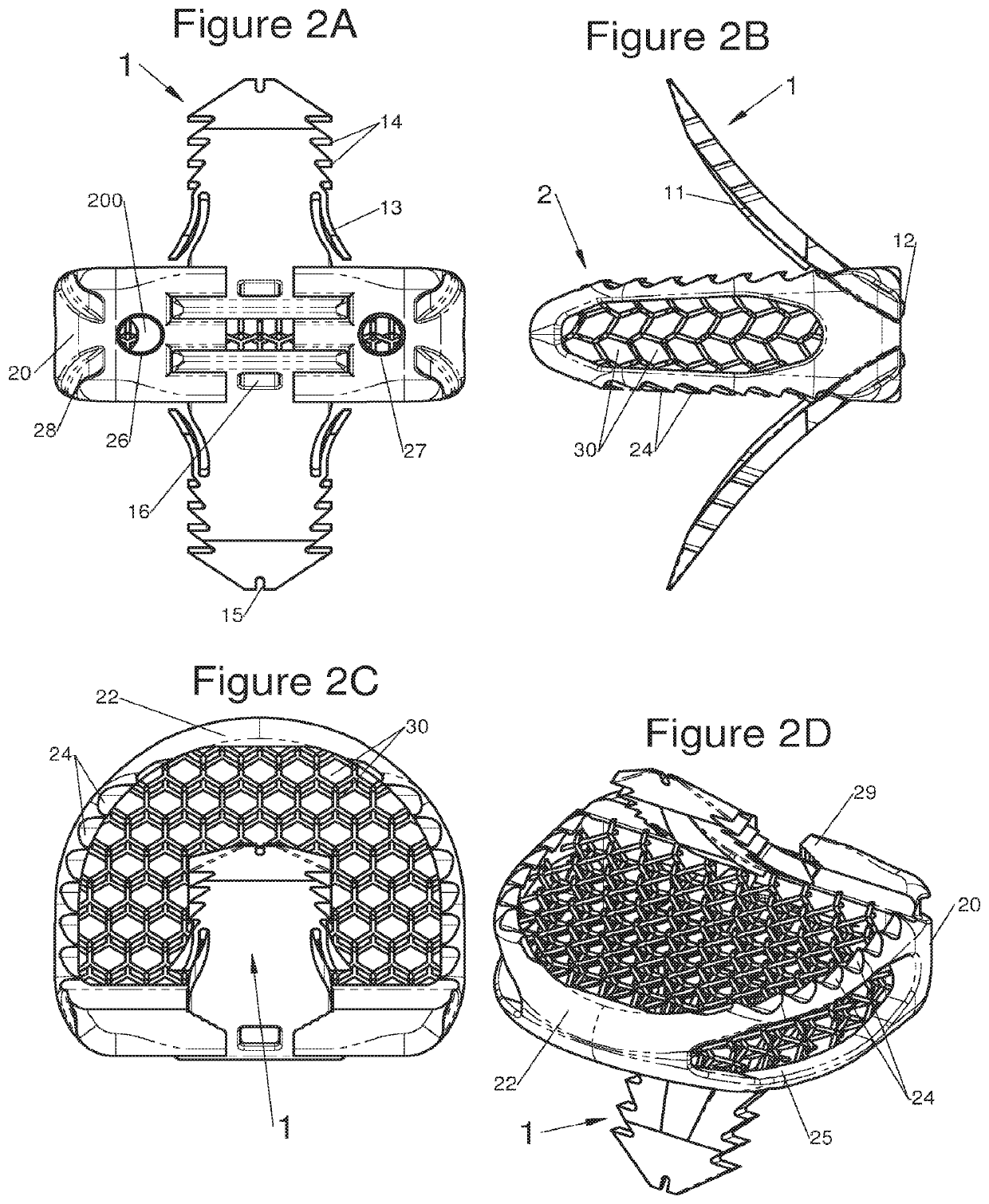 Vertebral system, implant and inserts for vertebral system