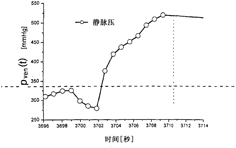 Method and device for recognition of paravasal bleeding