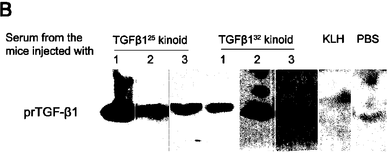 Synthetic peptide vaccine of B cell epitope based on TGF(transforming growth factor)-beta1 and application thereof