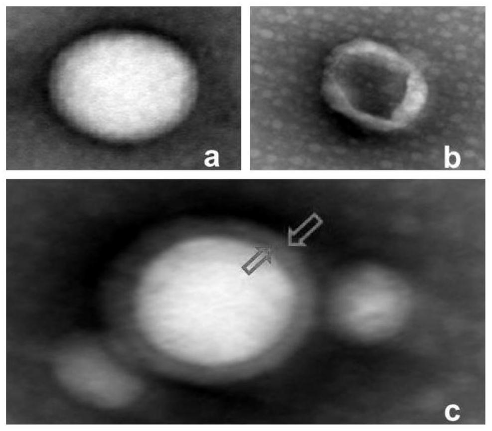 Bionic drug-loaded nanoparticles for specific targeting pulsed electric field ablation postoperative inflammatory region and preparation method thereof