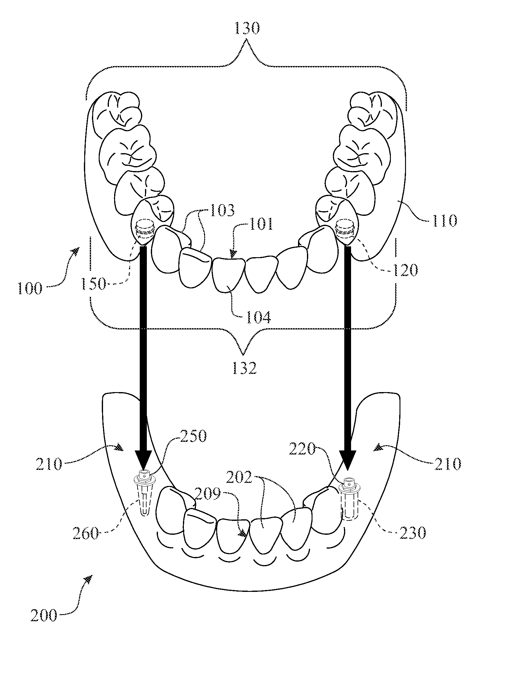 Dental appliance