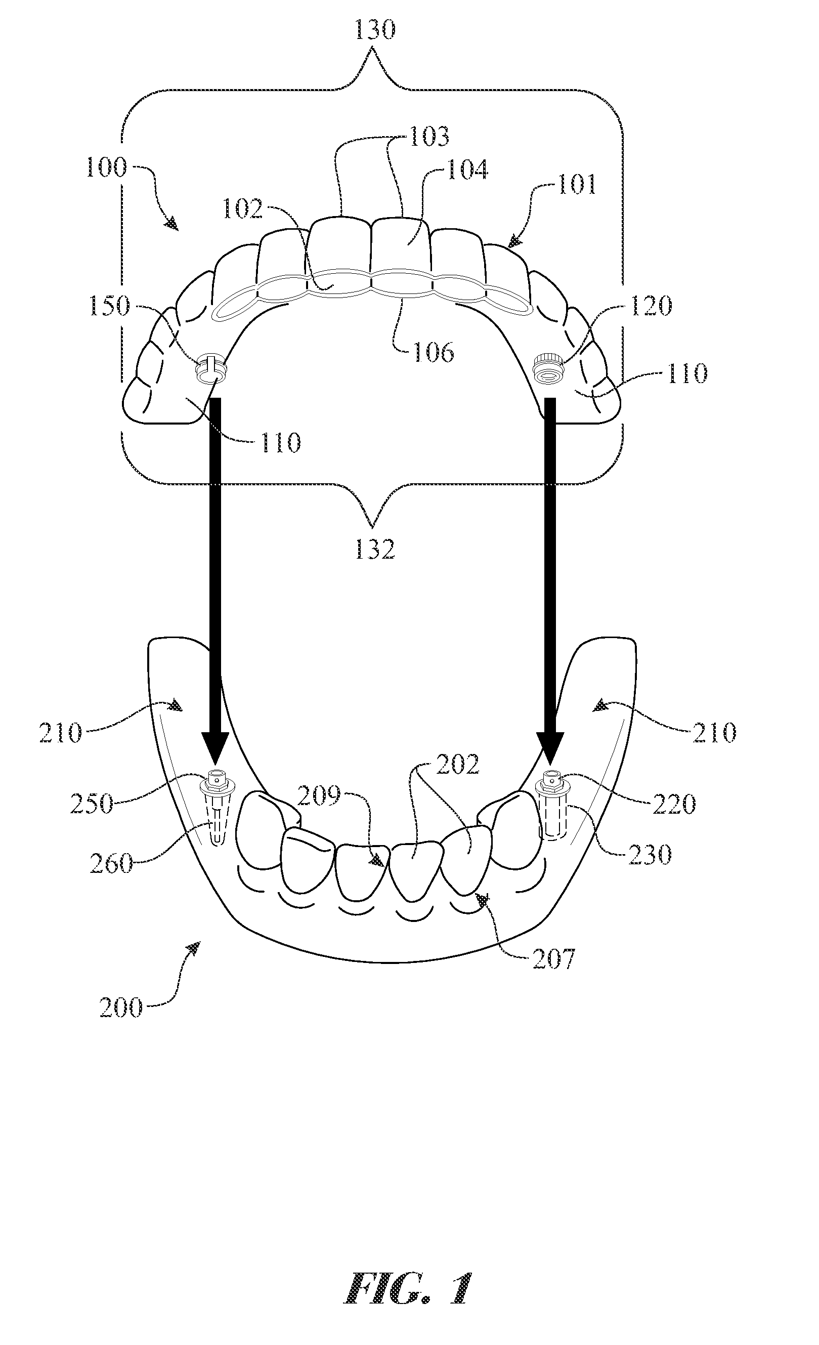 Dental appliance