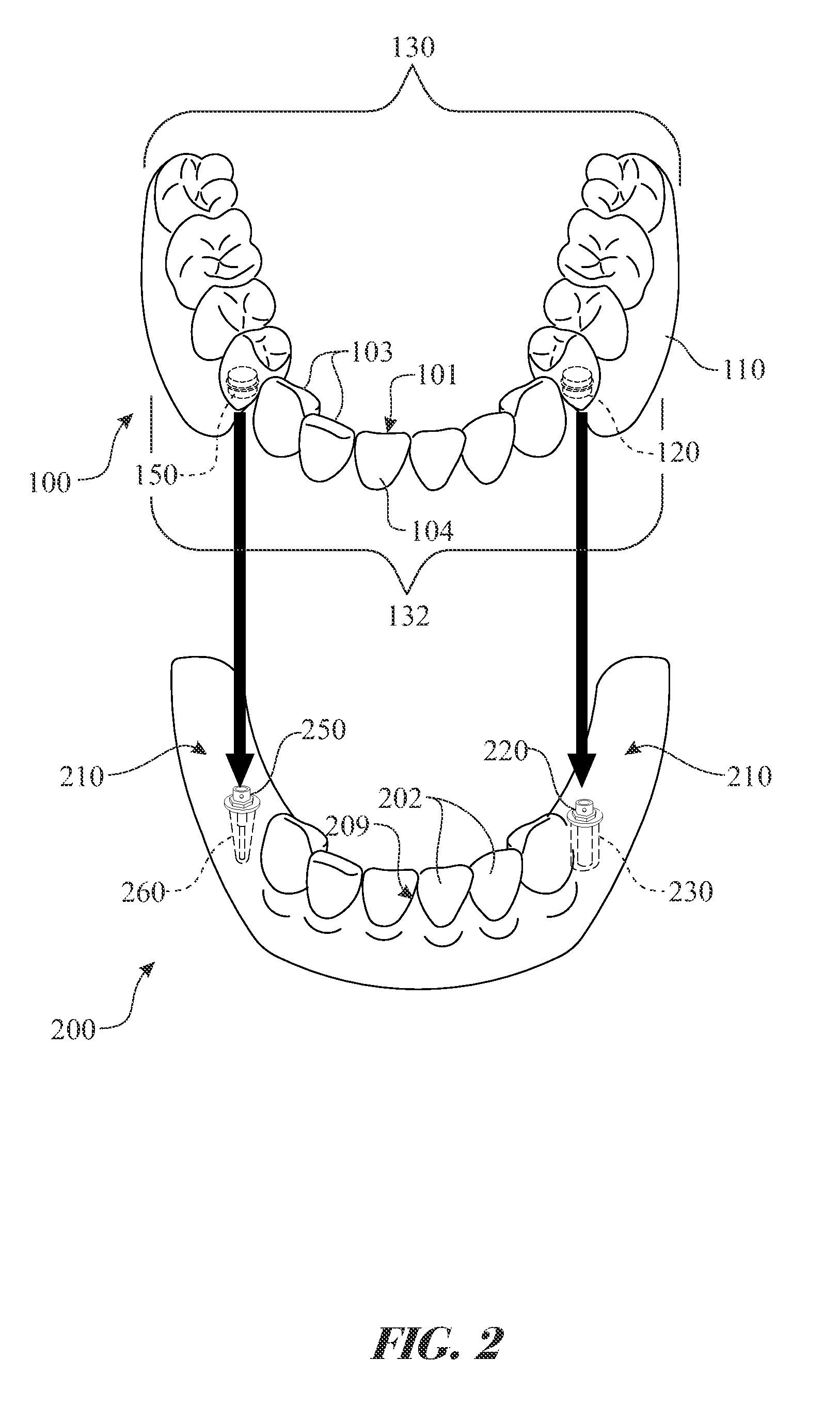 Dental appliance