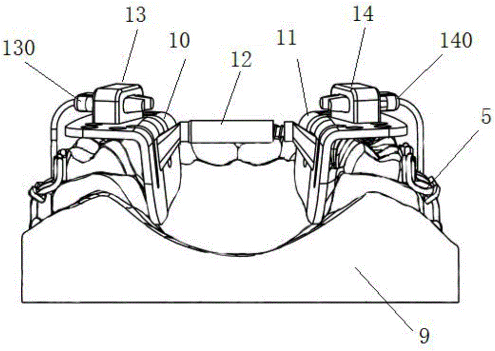 Orthodontic bracket indirect bonding precise positioning system and application method