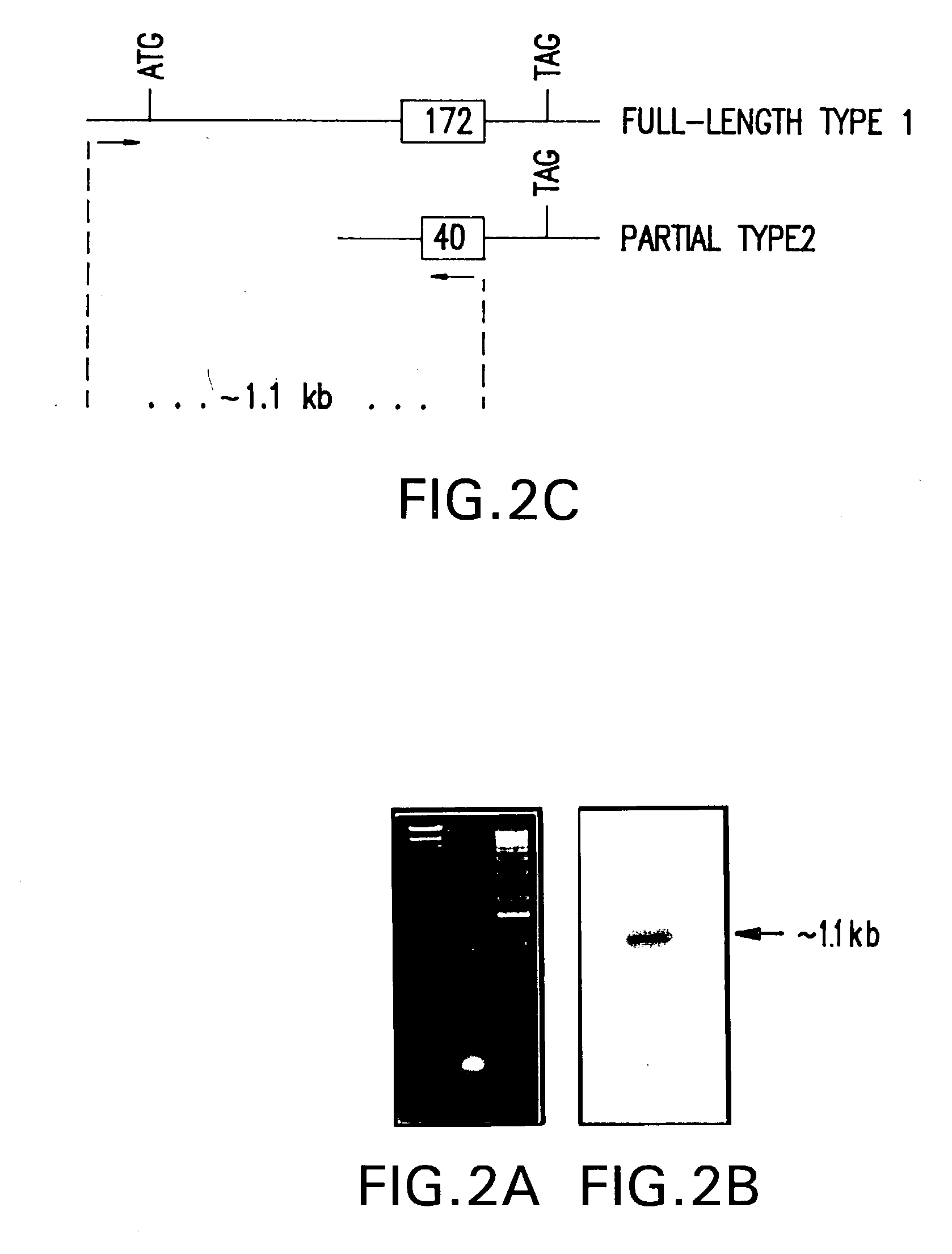 Acid sphingomyelinase gene and diagnosis of Niemann-pick disease