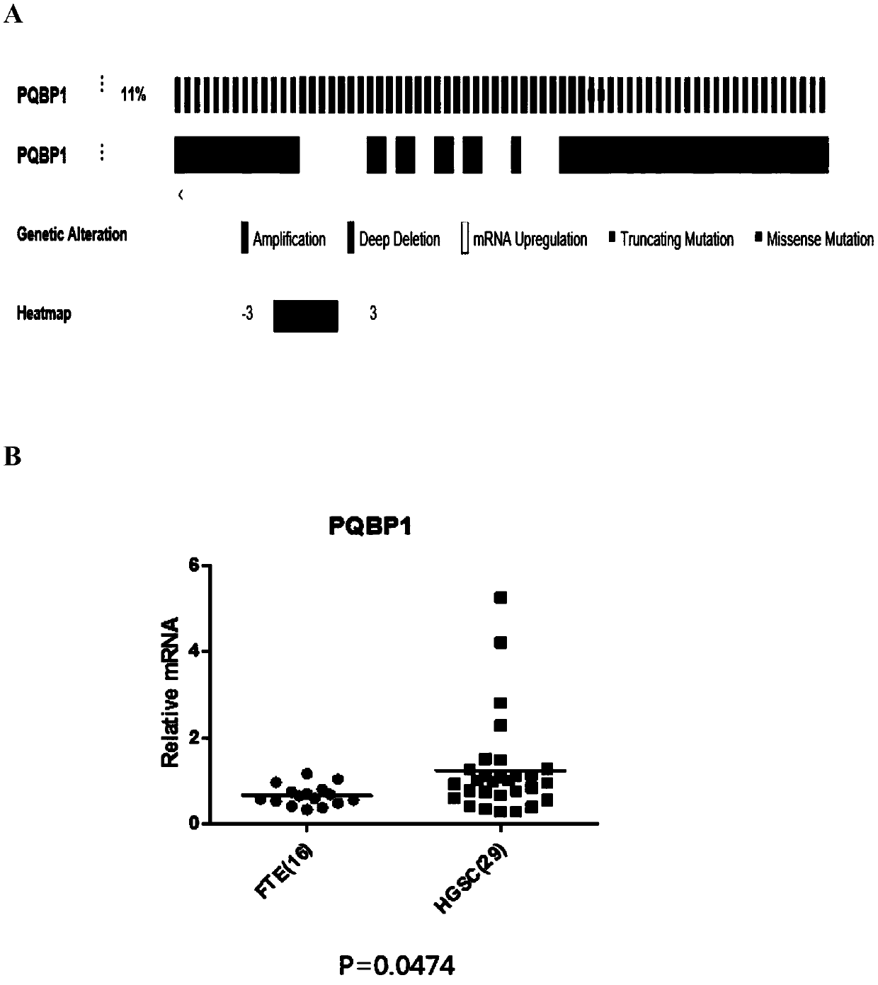 Application of PQBP1 in ovarian cancer diagnosis and treatment