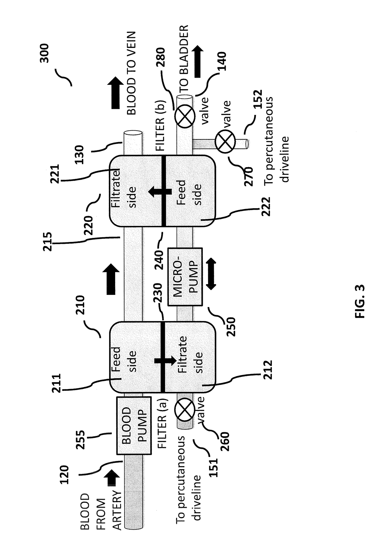 Implantable renal replacement therapy